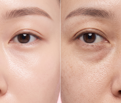 Medicube Collagen Volume Multi Balm | Anti-Aging for Young Skin
